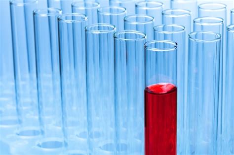 Premium Photo | Blood tube laboratory hematology glass environment pipette
