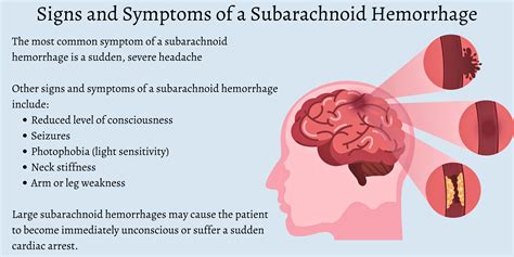 What Is Subarachnoid Hemorrhage Symptoms Causes And Prevention | The ...