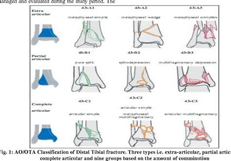 Distal Tibia Fracture Classification