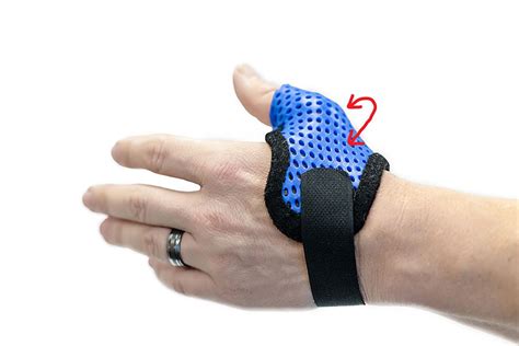 CMC Arthritis Orthosis in the Hand | CMC orthosis