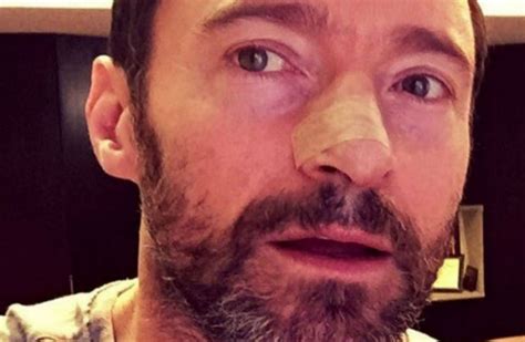 Hugh Jackman Is Being Treated For Skin Cancer Again