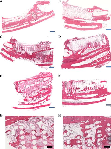 H&E staining of histological sections formed by implantation of a no... | Download Scientific ...