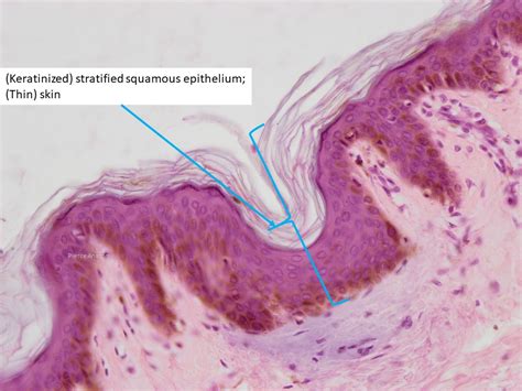 Stratified Squamous Epithelium Keratinized Skin