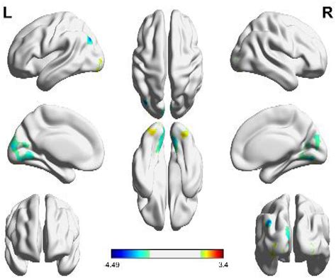 Frontiers | An fMRI study of visual geometric shapes processing