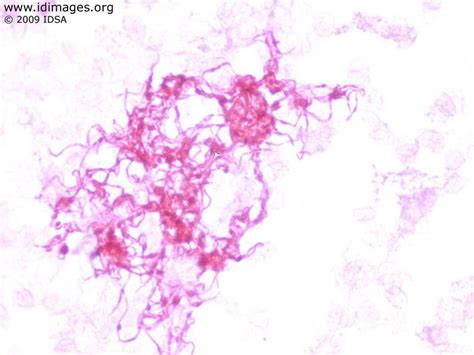 Streptobacillus moniliformis - Alchetron, the free social encyclopedia