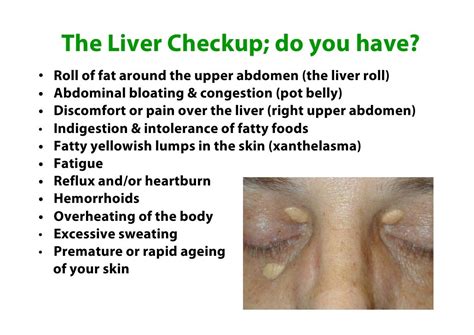 Liver Health