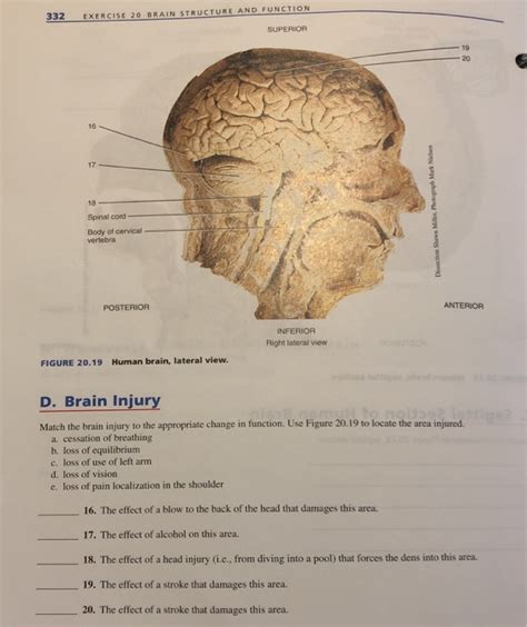 Solved FIGURE 20.16 Midsagittal section of the human brain | Chegg.com