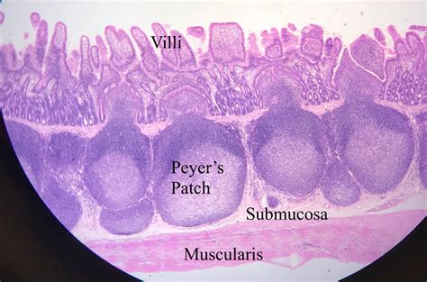 Duodenum Jejunum Ileum Histology – NBKomputer