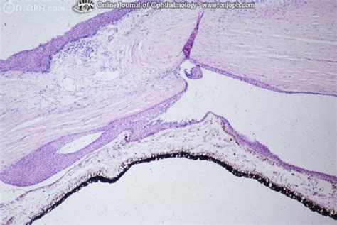 Atlas of Ophthalmology