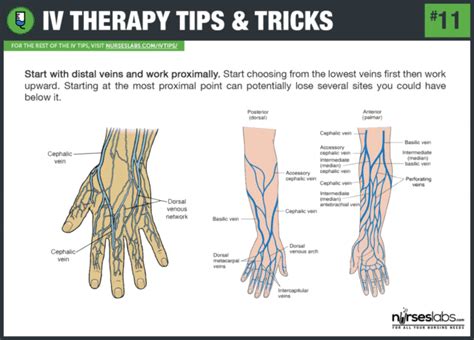 50 Intravenous Therapy (IV) Tips and Tricks For Nurses