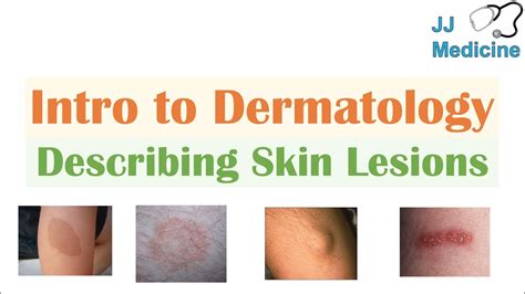 Introduction to Dermatology | The Basics | Describing Skin Lesions (Primary & Secondary ...