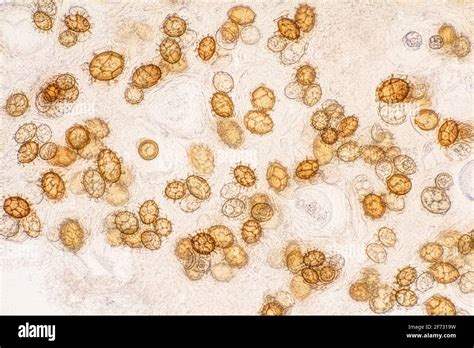 Fungal Spores Under Microscope