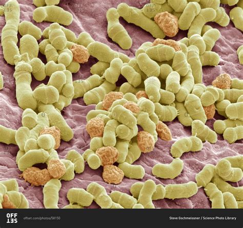 Athlete's foot fungus under a Color scanning electron micrograph. stock photo - OFFSET