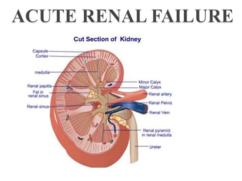 Blog Archives - Dr. Satish - Nephrologist & Transplant Physician