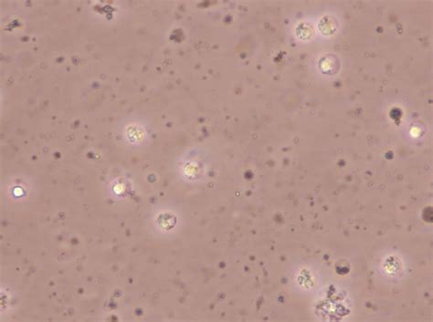 working: cell culture contamination-black spot swimming