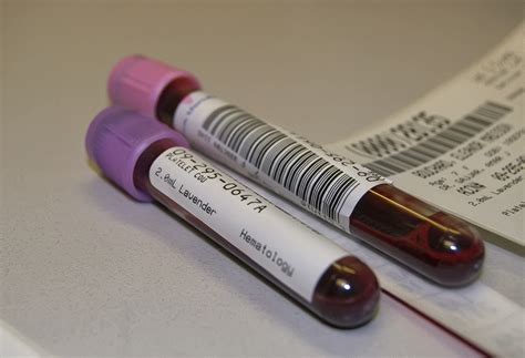 Can A Simple Blood Test Detect Cancer? | Cancer articles | Body & Health Conditions center ...