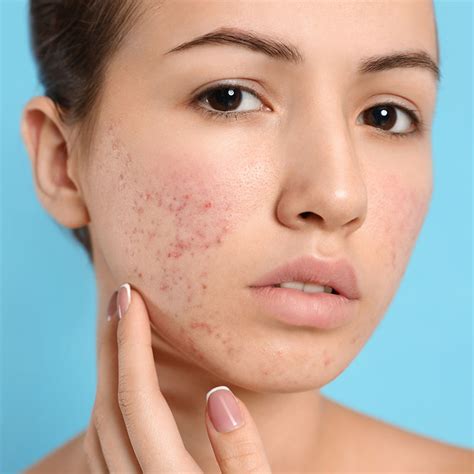 Skin Conditions | Sigma Dermatology