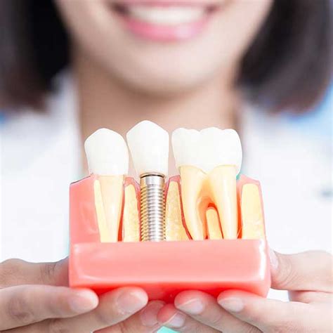 Dental Implants Near Me | Dental Implants Before & After