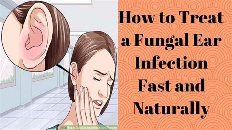 How to Treat a Fungal Ear Infection Fast and Naturally - YouTube | Ear infection remedy, Ear ...