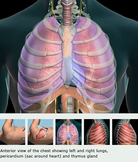 VATS Procedure Video Assisted Thoracic Surgery