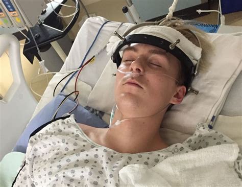 Sherwood Park teen recovering from broken neck suffered at trampoline park | Globalnews.ca