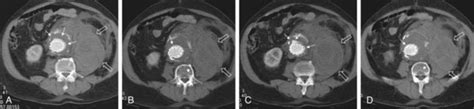 CT scan – Brian's Radiology Learning Diary