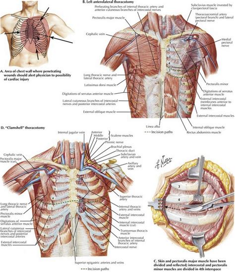 Emergency Thoracotomy for Trauma | Clinical Gate