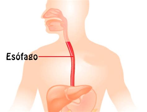 Cáncer de esófago: síntomas, tratamientos y tipos