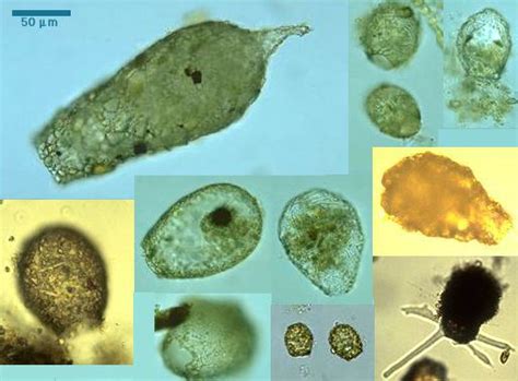 Protist Movies: Difflugia