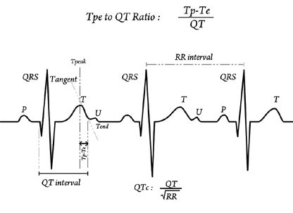 Bazett formula and Tp-Te/QT ratio | Download Scientific Diagram