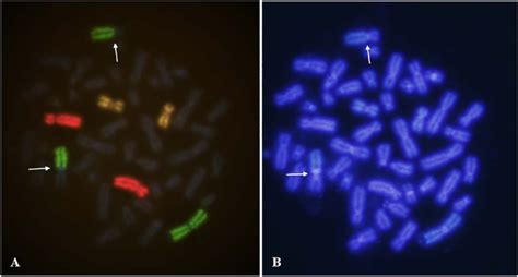 Three-colored FISH of chromosome pairs #1 (green), #4 (red) #11 ...