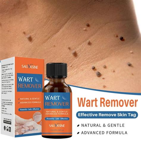 Salicylic Acid Wart Removal