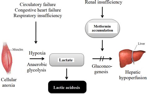 Metformin Lactic Acidosis Treatment