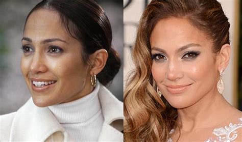 Jennifer Lopez Nose Job Plastic Surgery Before and After | Celebie