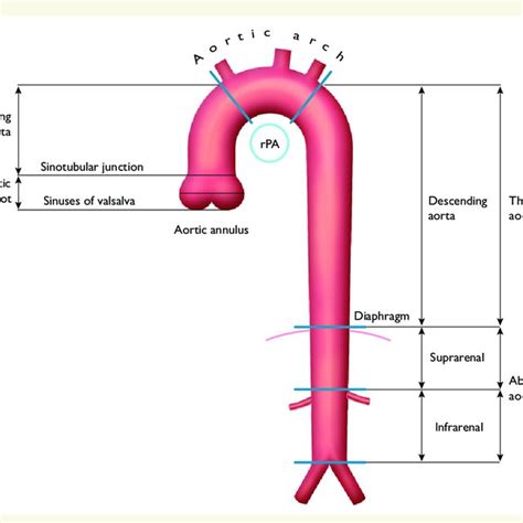 Abdominal Aorta Diameter