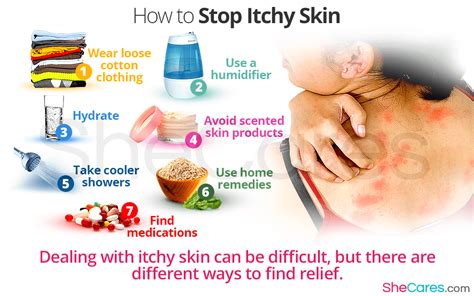 How to Stop Itchy Skin | Itching skin, Itchy skin, Dry itchy skin