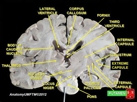 Putamen
