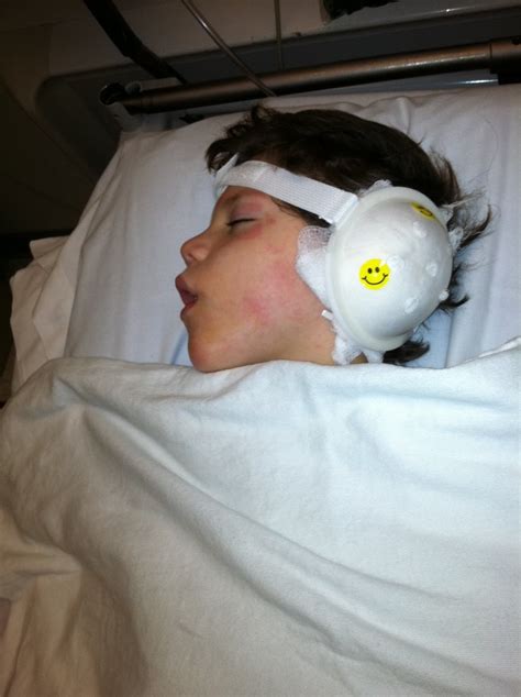 Let's Fill the Van!: Cochlear Implant Surgery - GRAPHIC picture WARNING