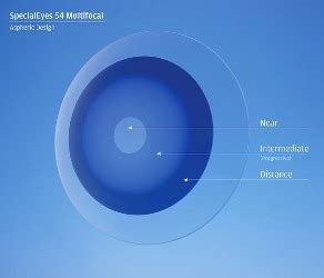 An Introduction to Custom Multifocal and Toric Multifocal Contact Lenses