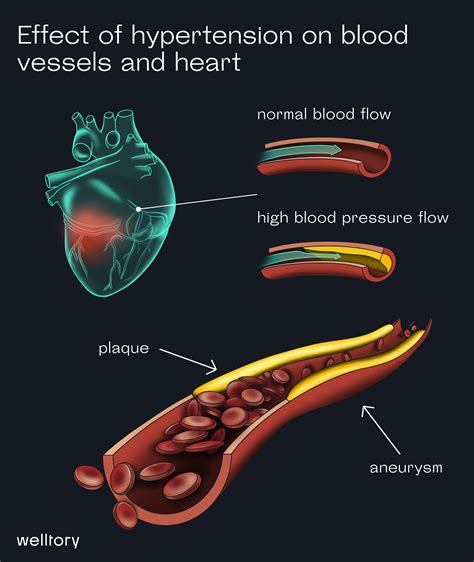 What is Blood pressure and how to analyze it with Welltory?