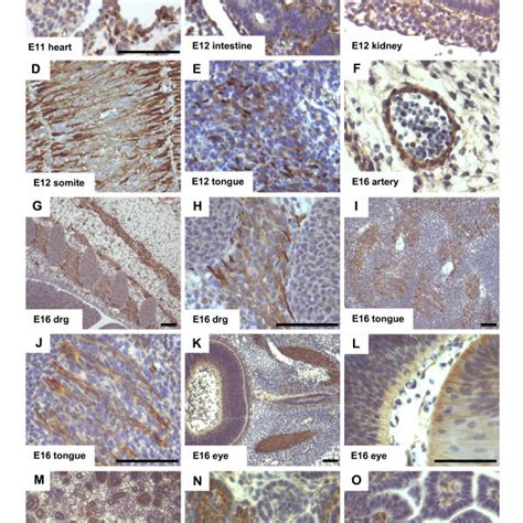 Expression of G-CSF and its receptor on the RNA level. G-CSF receptor... | Download Scientific ...