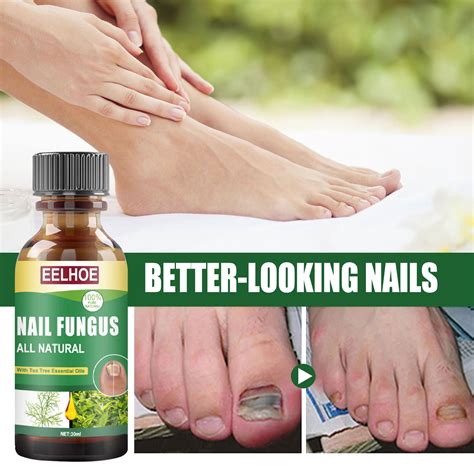 3 Pack Nail Fungus Treatment, Restores the Healthy Appearance of Nails Discolored or Damaged by ...