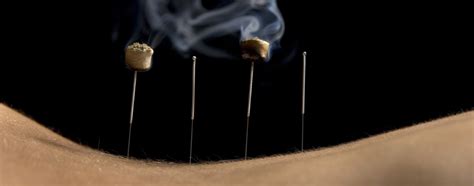 What is Moxibustion - Moxibustion San Diego by Makari Wellness