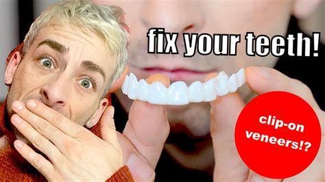 I ordered TRUSMILE VENEERS to fix my Gap...this is what I got... - YouTube