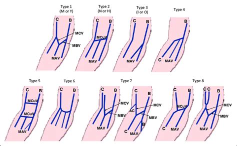 Median Cubital Vein Venipuncture