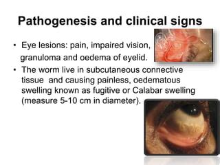 Onchocerciasis (Onchocerca volvulus) | PPT