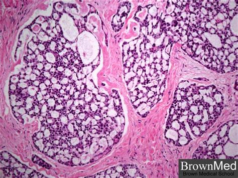 Adenoid Histology