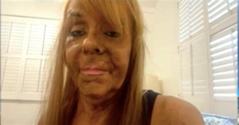 'Tan Mom' Patricia Krentcil Claims She Cut Down On Tanning