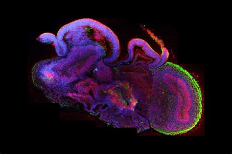 Brain Organoids - Serious Science