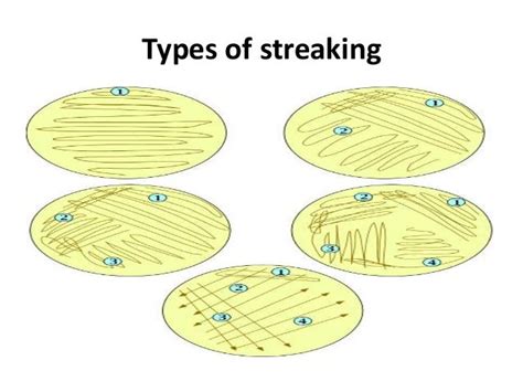 ️ What is pure culture technique. Streak Plate Method (Theory) : Microbiology Virtual Lab I ...